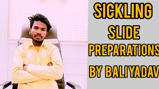 sickling test or sickling slide preparations or sickle cell anemia test in Hindi by yadav MLT [upl. by Baillie]