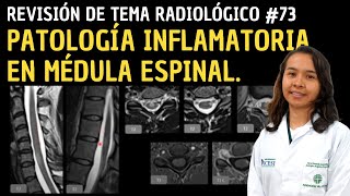 Revisión de tema 73 Patología inflamatoria en médula espinal [upl. by Emmott618]