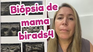 CONTANDO PRA VOCÊS SOBRE O ACHADO NA MINHA MAMA Cisto complexo Birads 4 [upl. by Bove]