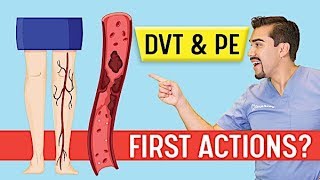 DVT Animation Deep Vein Thrombosis and Pulmonary Embolism PE Memory Tricks for Exams NCLEX [upl. by Illib852]