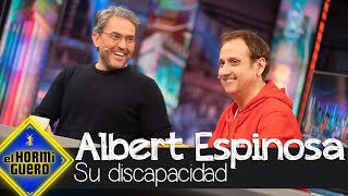 Albert Espinosa habla sobre su discapacidad  El Hormiguero [upl. by Harim]