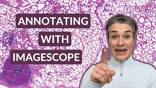 Aperio ImageScope  Free Annotation Tool for Pathology [upl. by Jeffy]