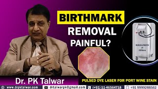 Is Birthmark Removal Painful Pulsed Dye Laser for Port Wine Stain by Dr PK Talwar [upl. by Kylynn]