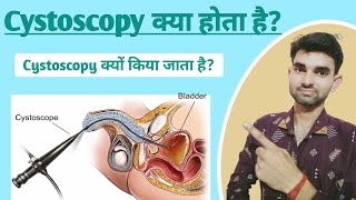 Cystoscopy in Hindi  Cystoscopy meaning  Purpose and Complications of Cystoscopy [upl. by Hilliard189]