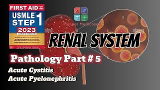 Acute Cystitis and pyelonephritis for USMLE Step 1Pathology part 5UrduHindi [upl. by Attevad]