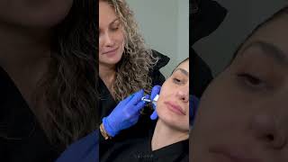 Jawline Contouring with JUVÉDERM VOLUX  Nurse Natalia [upl. by Schatz819]