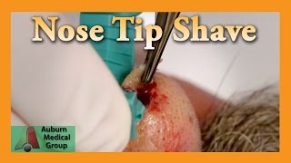 Nose Shave Biopsy Results in a Brown Noser  Auburn Medical Group [upl. by Arlee]