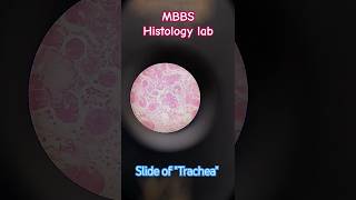 Histology lab 🔬 Best slide of Trachea tissue  MBBS life 🥼 youtubeshorts mbbs neet [upl. by Teferi643]