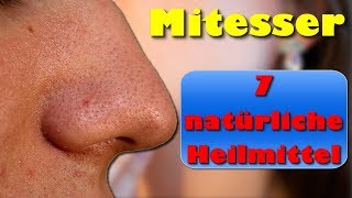 Mitesser – 7 Natürliche Heilmittel gegen Mitesser und Pickel [upl. by Mellicent]