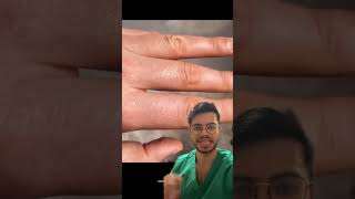 Dehydration clinical sign dayinthelifeofamedstudent doctor doctorreacts doctorreacts [upl. by Packston]