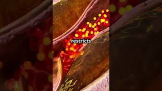 “Atherosclerosis Explained in 50 Seconds”hearthealth wellnesstips medfacts ournursesourfuture [upl. by Eibrik846]