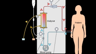 lhémodialyse Le mécanisme daction الية العمل تصفية الدم [upl. by Bohner]
