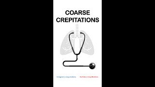 Coarse Crepitations [upl. by Latta]