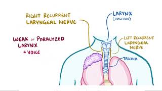 Pancoast tumors causes symptoms diagnosis treatment pathology [upl. by Ettelloc671]