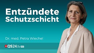 Schleimhautentzündungen  Ein Hinweis auf stille Entzündungen  Dr med Petra Wiechel  QS24 [upl. by Primo973]