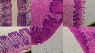 Tongue filiformCircumvalate amp fungiform papillae  histo slide [upl. by Scornik904]