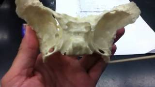 Sphenoid Bone [upl. by Llenrahs123]