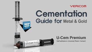 Cementation Guide for Metal amp Gold [upl. by Raseta]