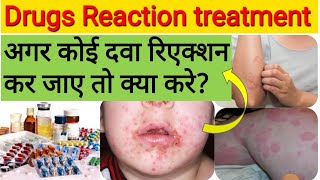 कोई दवा reaction कर जाए तो क्या करे  Drug reaction treatment  Medicine reaction treatment in hindi [upl. by Ettennod]