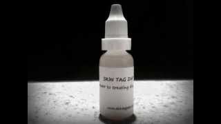 Skin Tag Remover  removing skin tags the natural way Skin Tag Zap [upl. by Kilan]