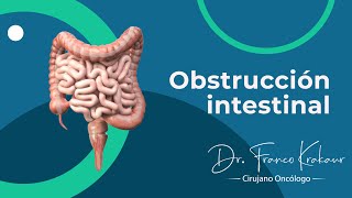 Obstrucción Intestinal  Dr Franco Krakaur Cirujano Oncólogo [upl. by Dahsra]