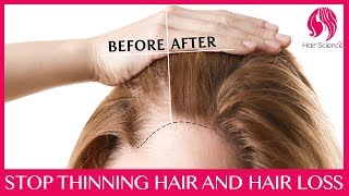 Stop hair falling out in clumps and thinning [upl. by Valeda]