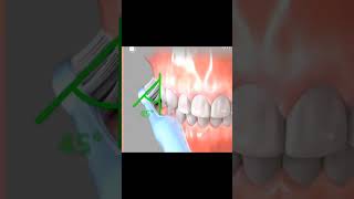 Correct Brushing technique 🤟😃 youtubeshorts dentistlife dentaleducation smile explore viral 😀😁 [upl. by Aipmylo]