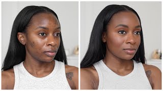 My NO FOUNDATION Summer Makeup Routine  Cover Acne Scars amp Hyperpigmentation Without Foundation [upl. by Udall]