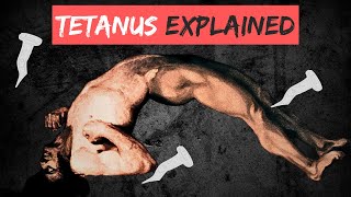 TETANUS explained in 10 Minutes [upl. by Elmina512]