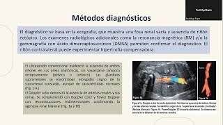 AGENESIA RENAL [upl. by Bullen]