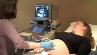 Maternity Pregnancy Ultrasound [upl. by Sinclare536]