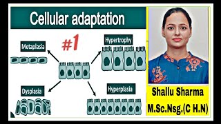 Cellular Adaptation TypesAtrophy HypertrophyPhysiological and pathological Atrophy [upl. by Aihsenyt271]