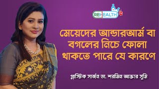 Reason for Female Underarm Swelling amp Treatment  মেয়েদের বগলের নিচে ফোলা থাকতে পারে যে কারণে [upl. by Guss]