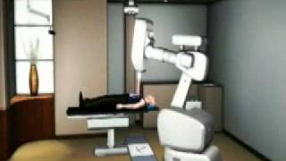 Cyberknife Treatment Overview [upl. by Tamara]