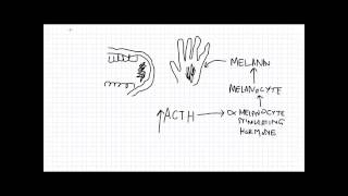 Adrenal Insufficiency [upl. by Lomasi]