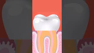 Paso a paso de una endodoncia  Cómo se realiza una endodoncia dentista [upl. by Louls779]