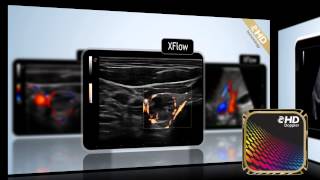 Esaote eHD Technology The New Era in Ultrasound [upl. by Jepum]