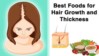 Best Foods for Hair Growth and Thickness [upl. by Glaab165]