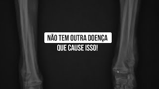 Caso clínico Osteodistrofia hipertrófica [upl. by Naujek]