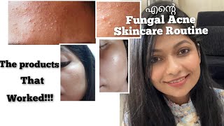 How I cleared My Fungal Acne  Skincare Routine for Fungal acne Products for Fungal Acne [upl. by Lamb]