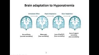 Management of Hyponatremia amp Hypernatremia in ICU By Dr Bikram Gupta [upl. by Wavell174]