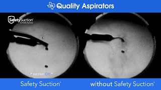 SafetySuction by Quality Aspirators  Schlieren Imaging Comparison [upl. by Takakura157]