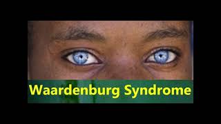 Waardenburg syndrome eyes [upl. by Pascasia]