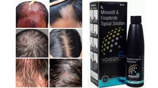 NOVEGROW Topical Solution Minoxidil amp Finasteride Topical Solution [upl. by Anehs829]