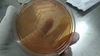 Aeromonas hydrophila Colony Morphology on Macconkey Medium and Biochemical Tests in TSI MIU and Cit [upl. by Theodor]