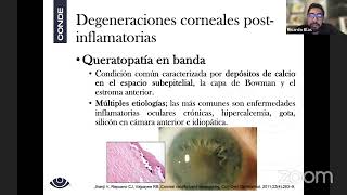 Degeneraciones corneales [upl. by Oruhtra348]