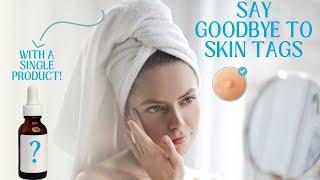 Skin Tag Removal  Causes and Treatment [upl. by Ewolram]