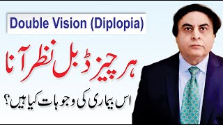 Diplopia Double Vision  Causes amp Treatment  By Dr Khalid Jamil [upl. by Ammann]