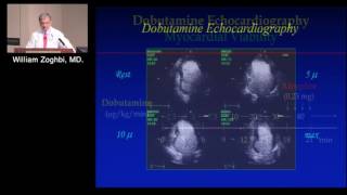 Heart Failure II Evaluating Myocardial Viability – Role of Multimodality Imaging January 24 2017 [upl. by Woodman]