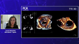 Echocardiographic imaging for transcatheter tricuspid intervention  Webinar [upl. by Mikaela]